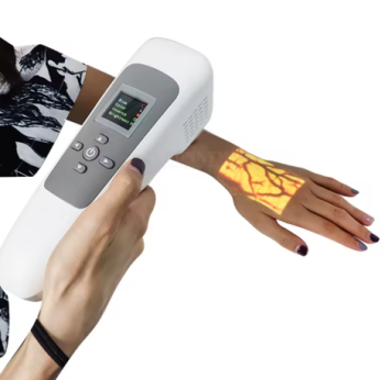 Portable Infrared Vein Finder – Handheld Vein Visualization Device